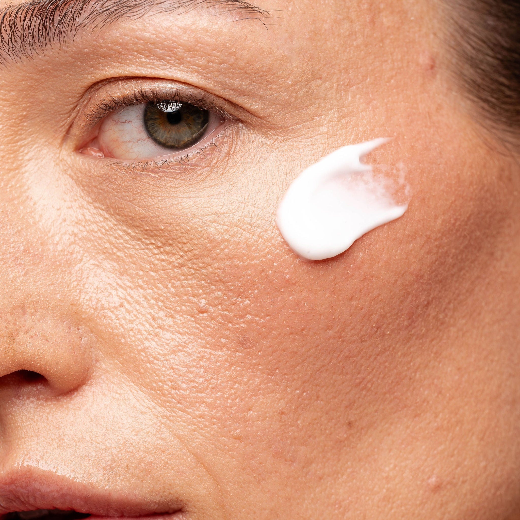 הזדקנות העור